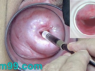 Japanese Endoscope Camera dominant Cervix Cam into Vagina